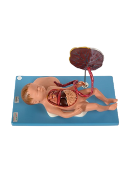 FETUS WITH VISCUS AND PLACENTA